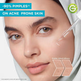 GETIT.QA- Qatar’s Best Online Shopping Website offers GARNIER SKIN ACTIVE FAST CLEAR ACNE PRONE SKIN BOOSTER 4%-- 30 ML at the lowest price in Qatar. Free Shipping & COD Available!